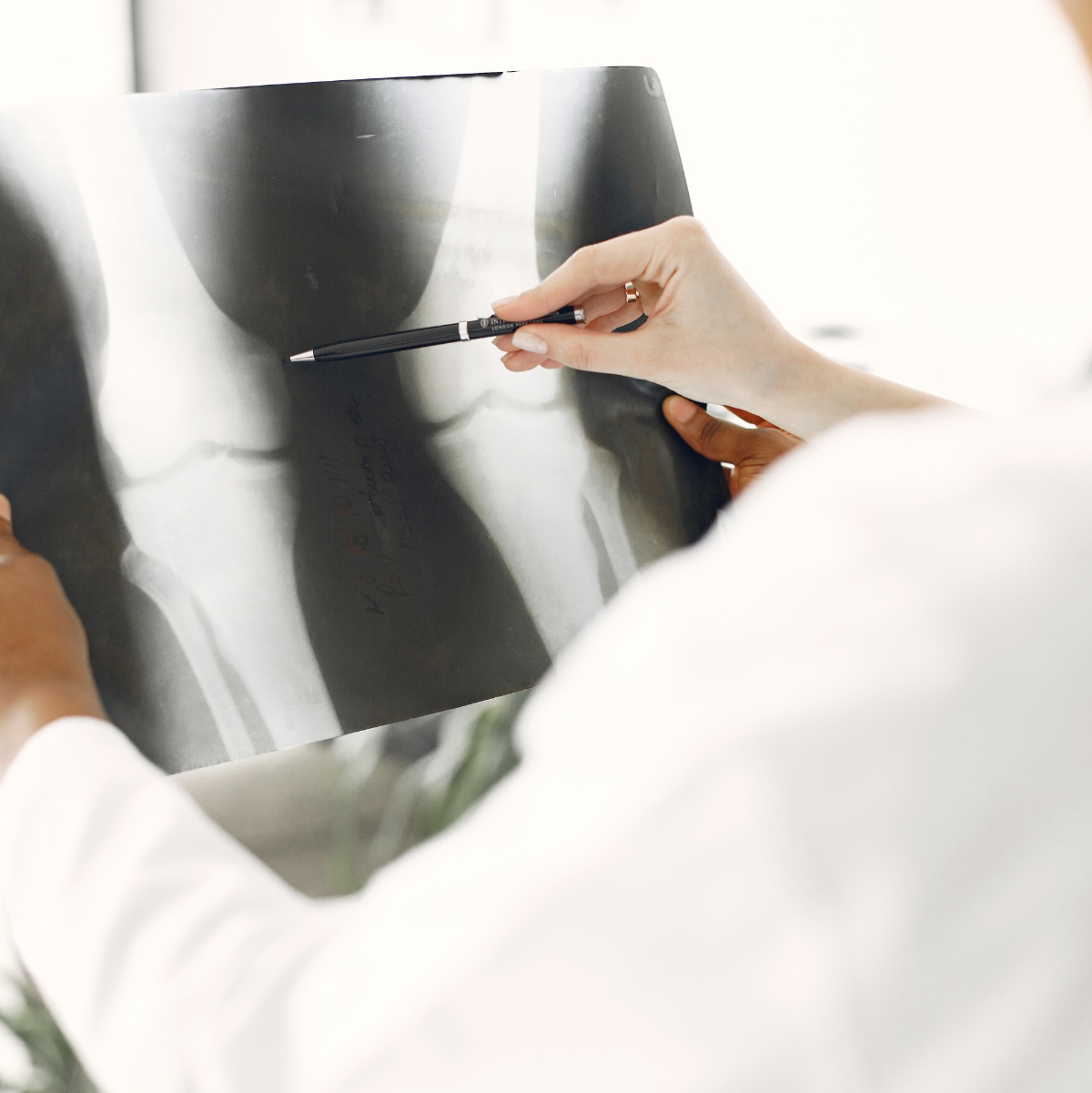 Médico revisa una radiografía de rodilla